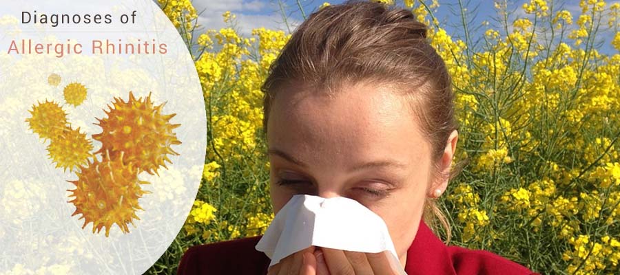 allergic-rhinitis-overview-causes-diagnoses-and-treatments